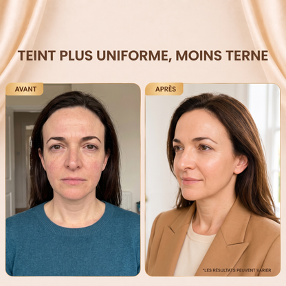 SoyeLIFT™ — Sérum aux Peptides de Soie