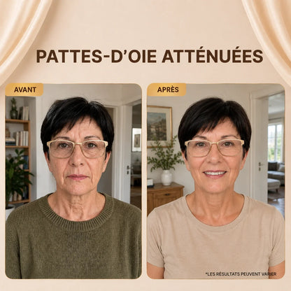 SoyeLIFT™ — Sérum aux Peptides de Soie